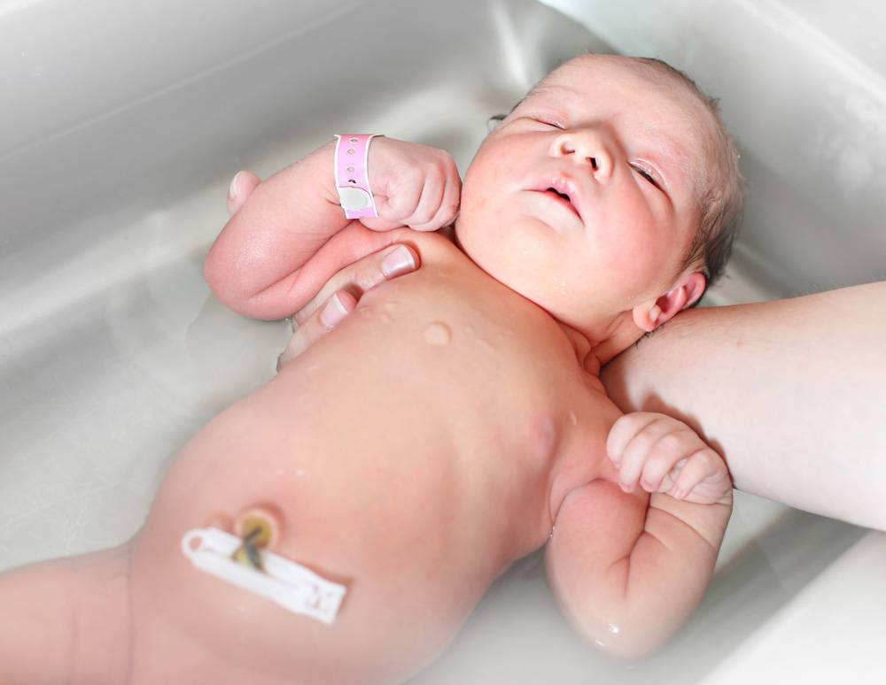 Кровит пупок у новорожденного: что делать, какие средства использовать, что говорит комаровский?