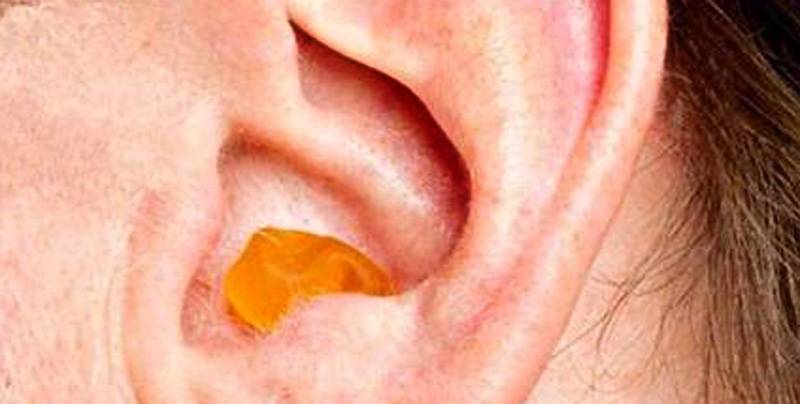 ᐈ серная пробка в ухе у ребенка. какие ее симптомы, и как лечить? | медицентр