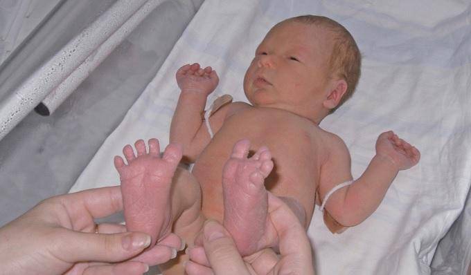Рефлексы новорожденных — классификация и методика исследования