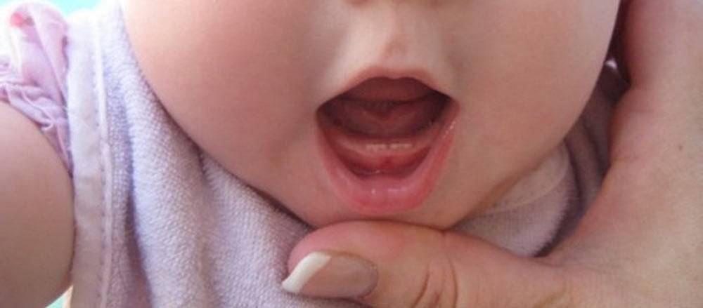 Заболевания слизистой оболочки полости рта у детей. распознать и устранить!