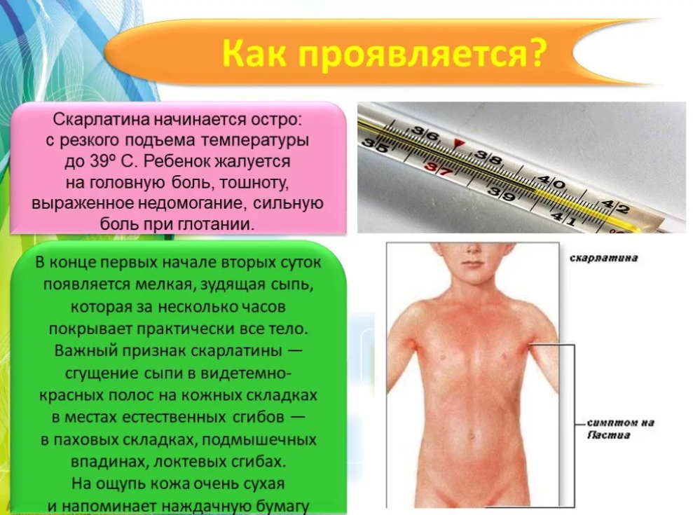 Скарлатина у детей информация для родителей картинки лечение признаки и симптомы лечение