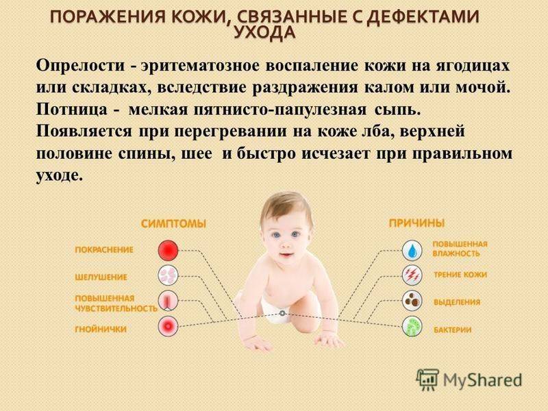 Потница или аллергия – как отличить