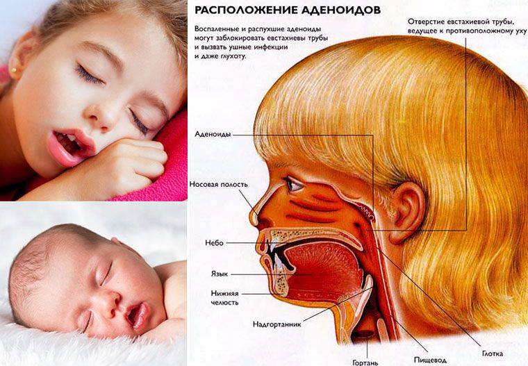 Грудничок храпит во сне: причины, лечение pulmono.ru
грудничок храпит во сне: причины, лечение