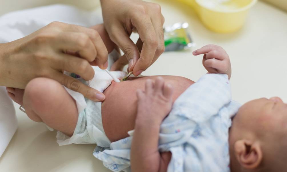Если кровит пупок у новорожденного: 3 основных правила обработки пупочной ранки от неотнатолога