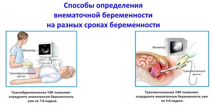 Как гинеколог определяет беременность при осмотре, может ли он ее увидеть на раннем сроке? | nail-trade.ru