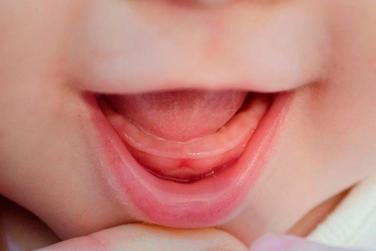 Фото как прорезываются зубы у детей
