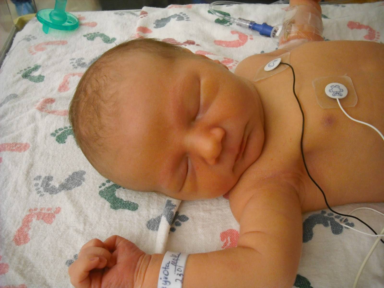 Желтуха новорожденных (неонатальная желтуха). причины, виды, классификация, симптомы и признаки