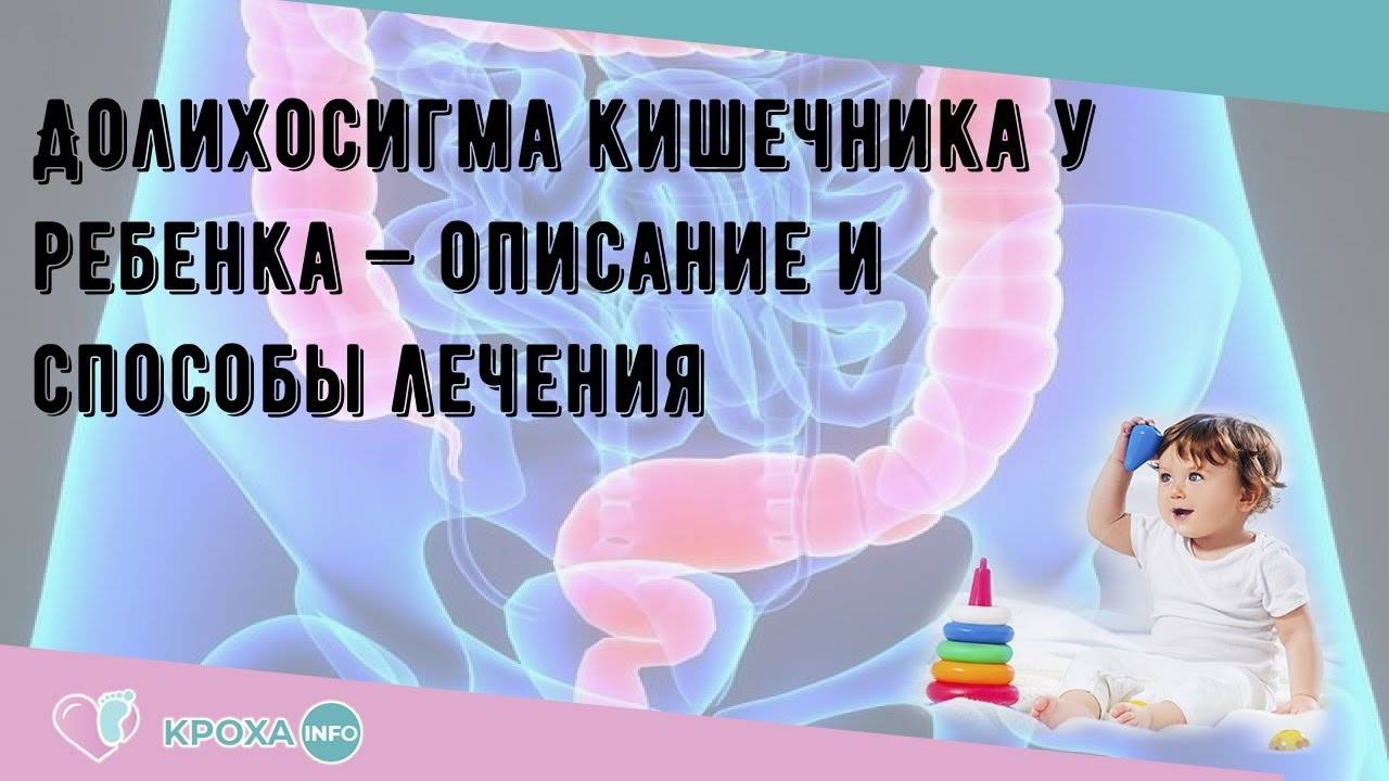 Долихосигма это