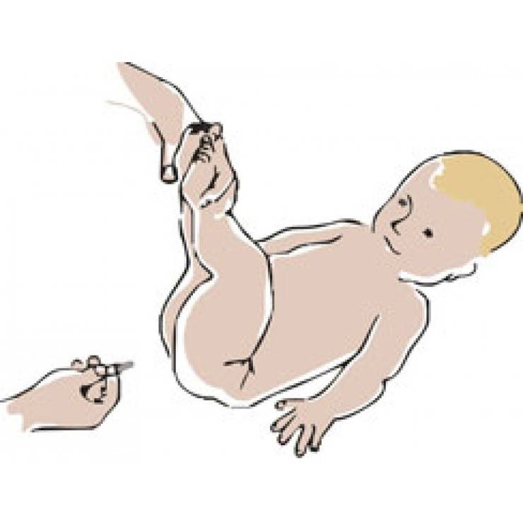 Как правильно использовать газоотводную трубочку для новорожденного: инструкция и советы