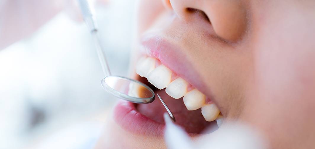 Лечение зубов во время лактации