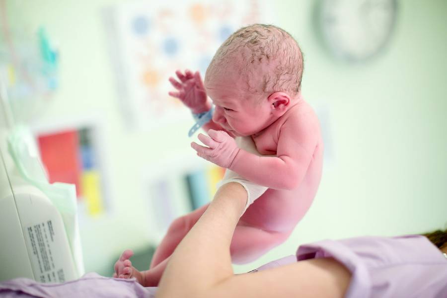 Набухание молочных желез у новорожденных