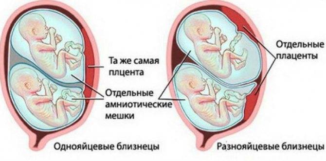 2 триместр беременности двойней: ощущения, признаки, развитие плодов