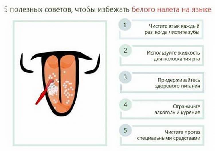 Пятна на языке у детей и грудничков: что значат белые и красные пятна - диагноз и лечение