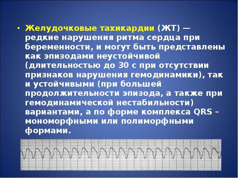 Тахикардия при беременности. Желудочковая тахикардия при беременности. Устойчивая желудочковая тахикардия. Желудочковая тахикардия ритм. Устойчивая и неустойчивая желудочковая тахикардия.