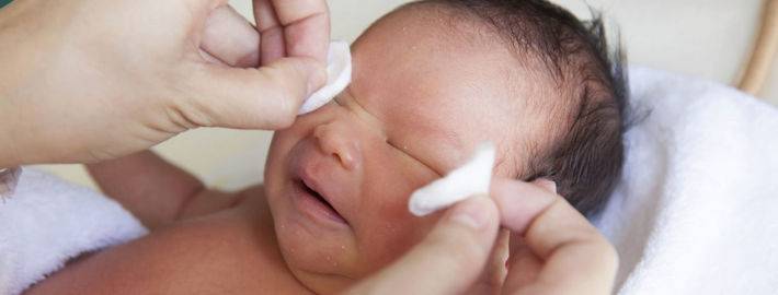 Родителям о дакриоцистите новорожденного  |  детская городская поликлиника №17