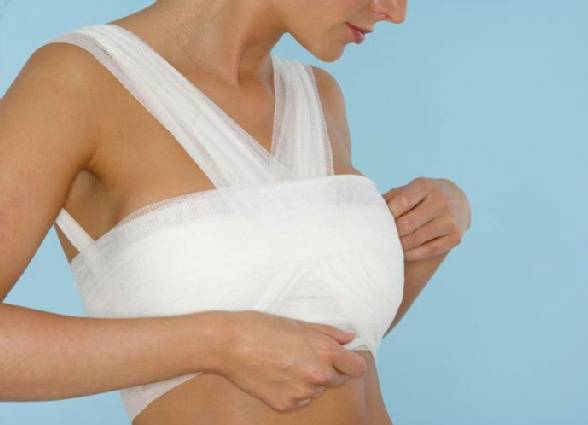 Как перетянуть грудное молоко правильно - методы перевязки груди для предотвращения лактации, нюансы и риски