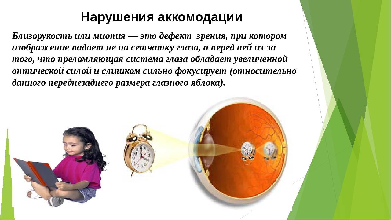 5 способов лечения спазма аккомодации у детей
