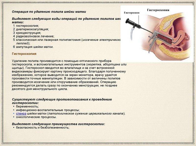 Послеоперационный период после гистероскопии эндометрия | университетская клиника
