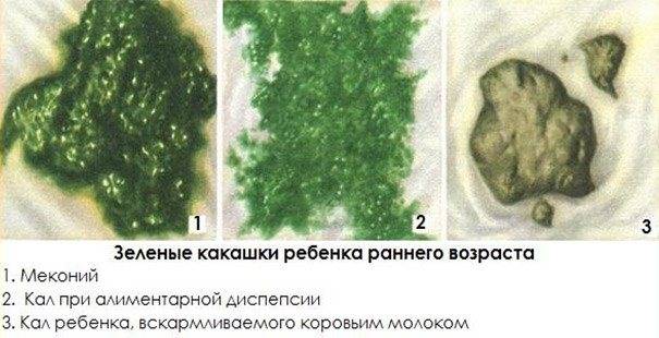Аллергический проктоколит у младенцев. - блог врача олега конобейцева