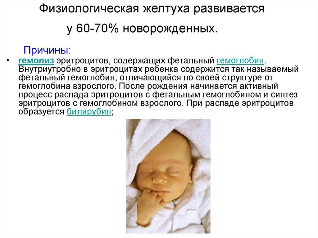 Гемолитическая болезнь новорожденных - "наша радость"