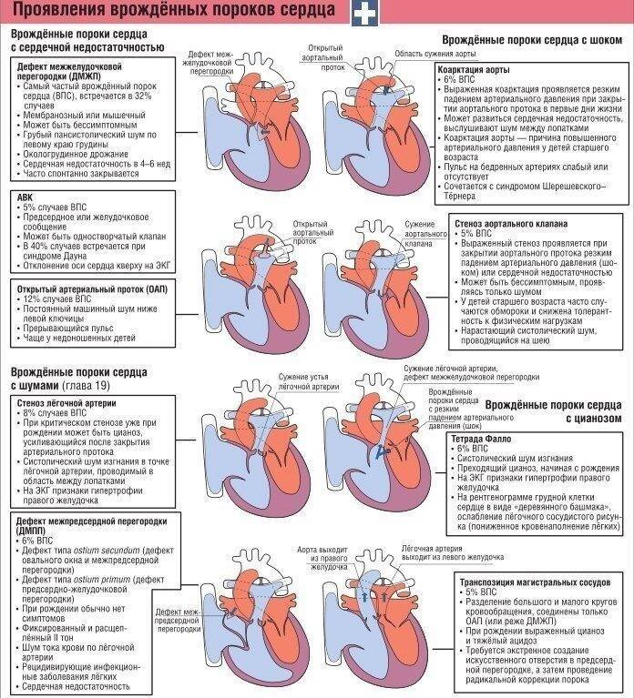 Как распознать врождённый порок сердца у ребёнка? Практические рекомендации от детского кардиолога