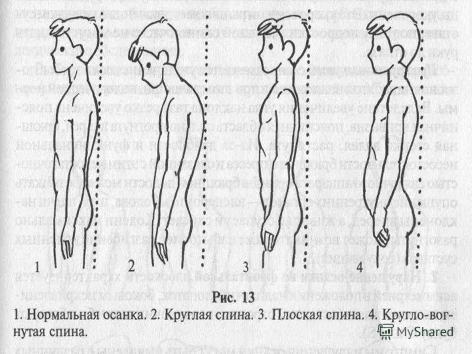 Картинки плоская спина