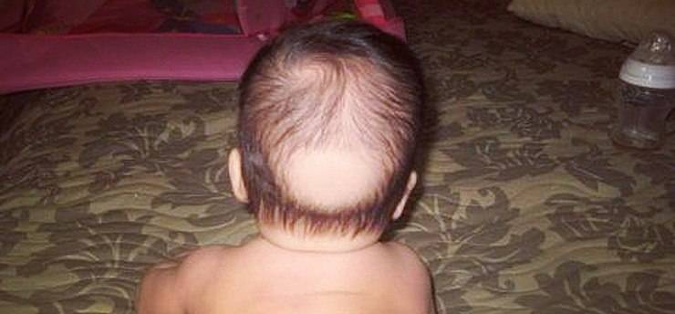 Как быстро растут волосы на голове у годовалого ребенка