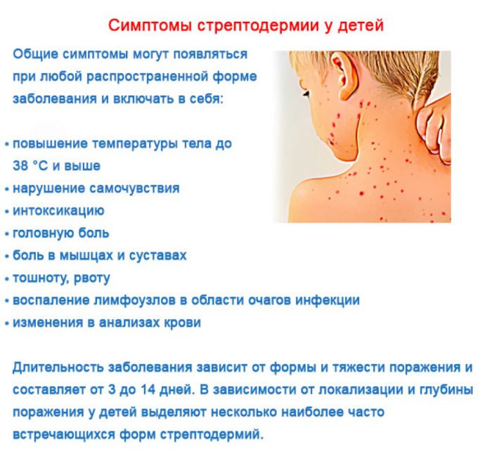 Стрептодермия у детей - признаки, причины, симптомы, лечение и профилактика - idoctor.kz