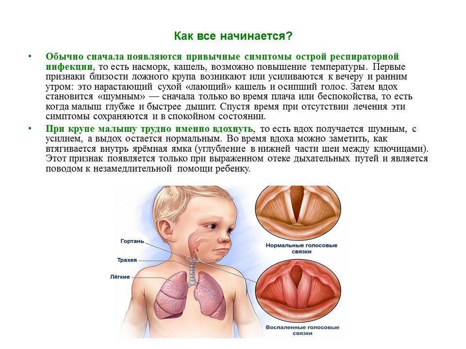 Хриплый голос у грудничка: причины, лечение pulmono.ru
хриплый голос у грудничка: причины, лечение