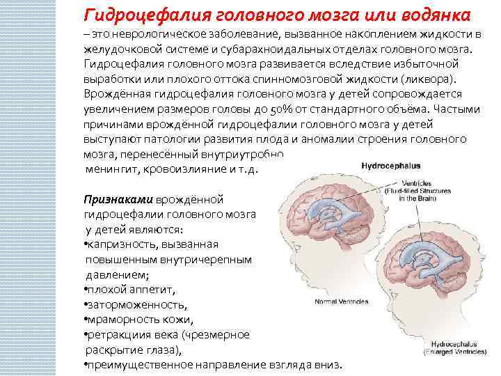 Опухоли головного мозга у детей: важность онконастороженности и особенности диагностики с позиции детского невролога | nasdr
