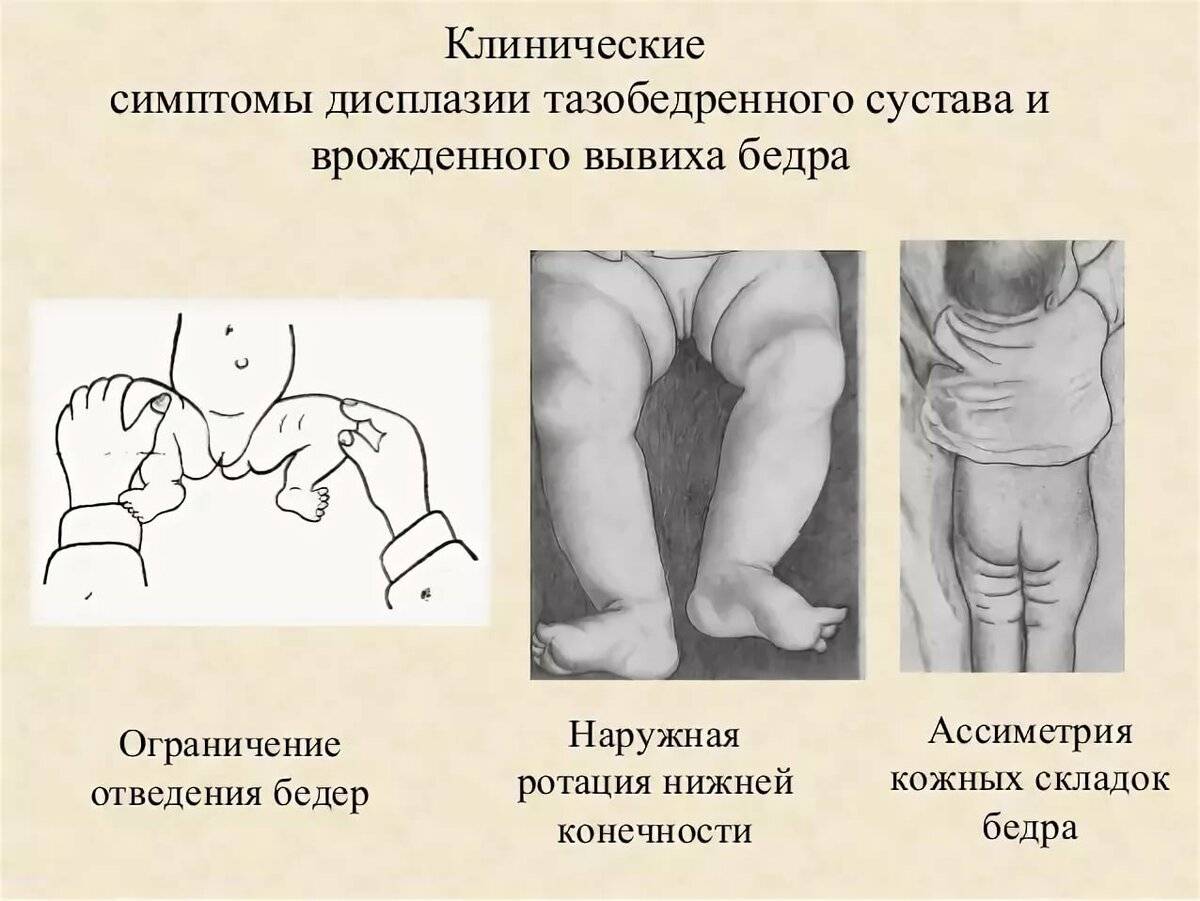 Усиление боли в конечностях при нагрузке у ребенка: причины, клинические проявления