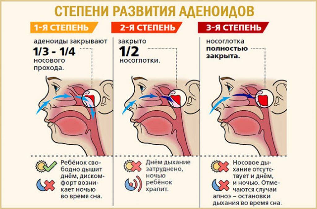 Вред храпа. симптомы и последствия осложненного храпа | buzunov.ru