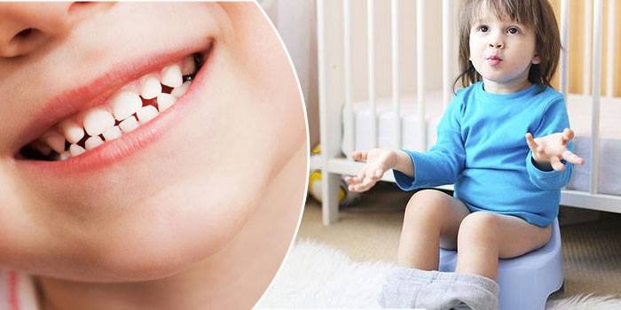 Лечение пульпита зубов – что это такое: как лечат заболевание в стоматологии и нужно ли удаление нерва