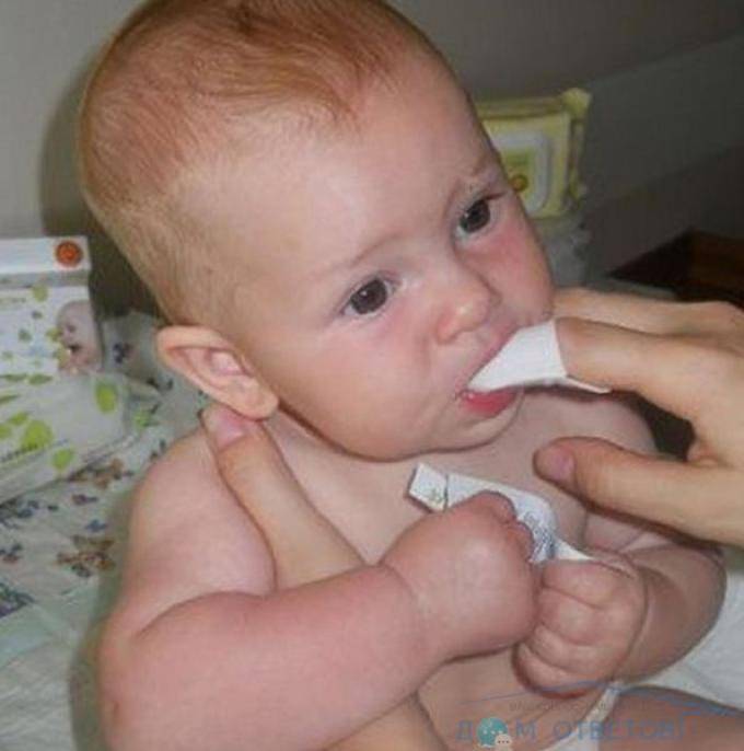 Чем обрабатывать молочницу. Молочница во рту у грудничка. Кандидоз полости рта у детей новорожденных.