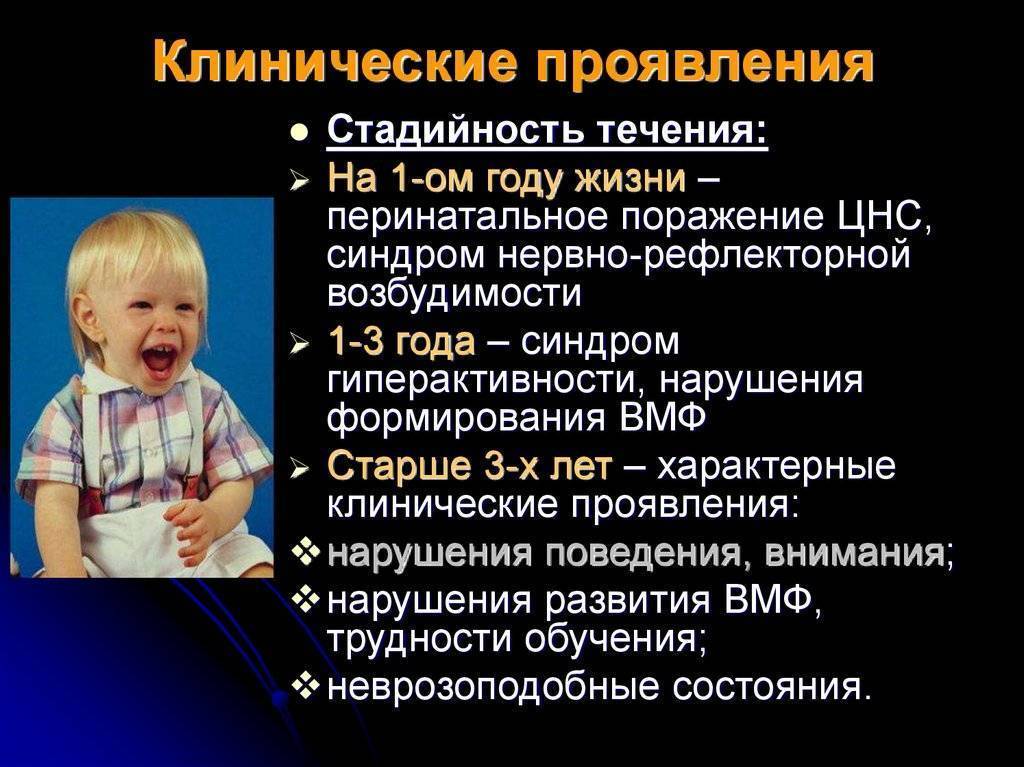 Профилактика последствий перинатальных гипоксических поражений центральной нервной системы у детей