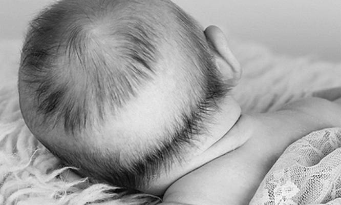 Почему у новорожденного грудничка выпадают волосы на голове: естественные и патологические причины / mama66.ru