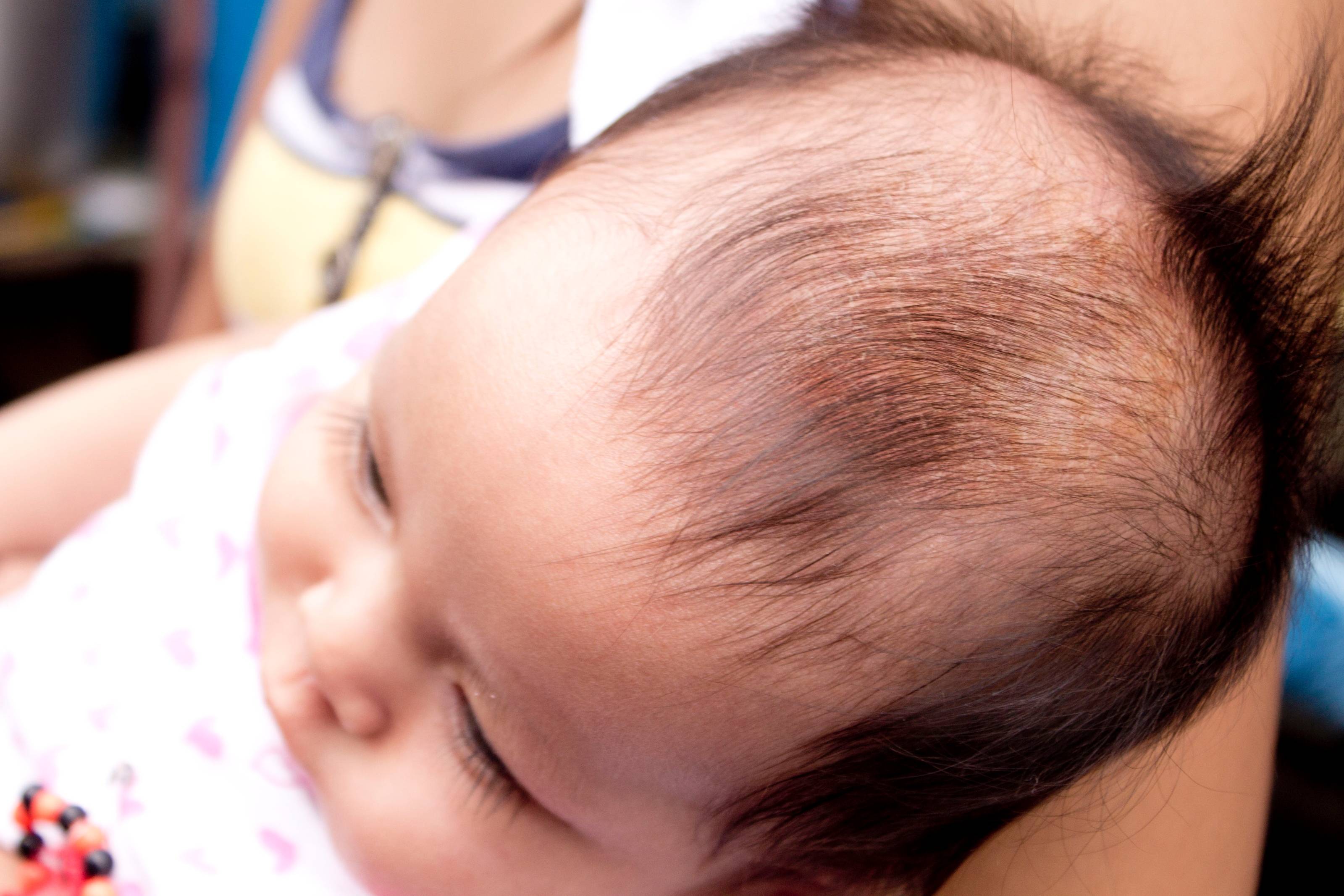 Доктор комаровский о том, как убрать корочки на голове у младенца