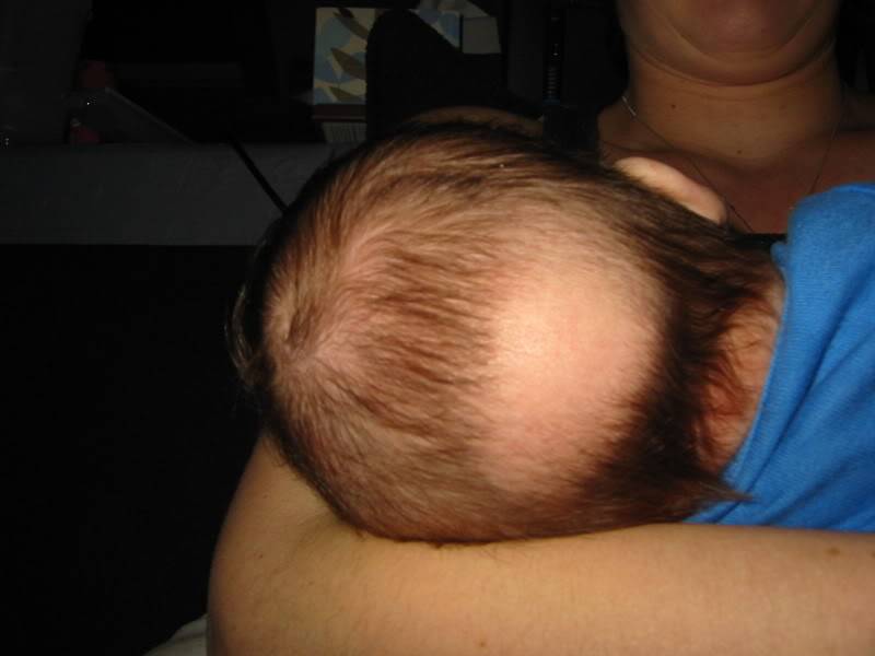 Слабые ногти и волосы, выпадение волос у детей: причины, патологии