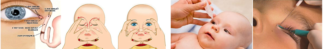 Непроходимость носослезного канала у детей