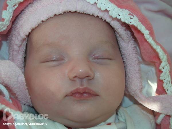 Цианоз носогубного треугольника: почему у грудничка или новорожденного синеет кожа вокруг рта