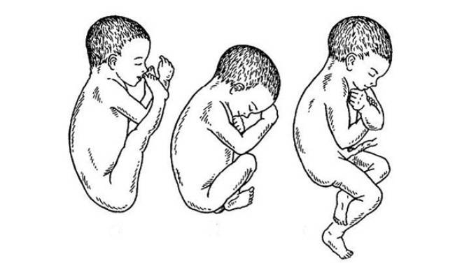 Во сколько недель малыш переворачивается головкой вниз или когда ребенок должен перевернуться головой вниз