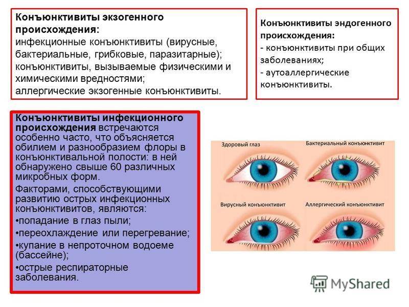 Глазные мази при лечении конъюнктивита у детей - энциклопедия ochkov.net