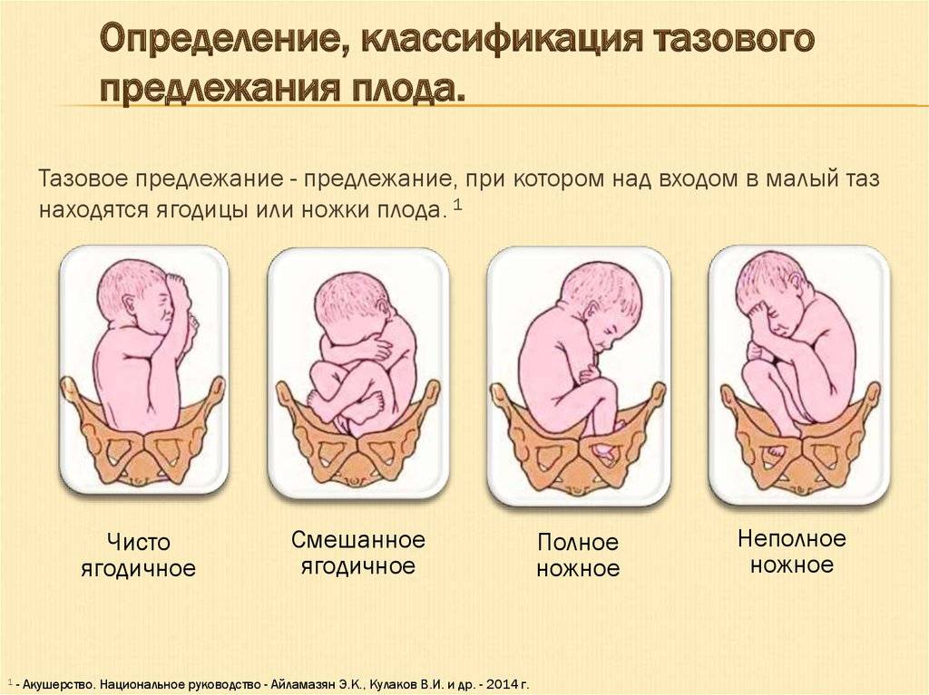 На каком сроке ребенок переворачивается вниз головой и принимает окончательное положение? | konstruktor-diety.ru