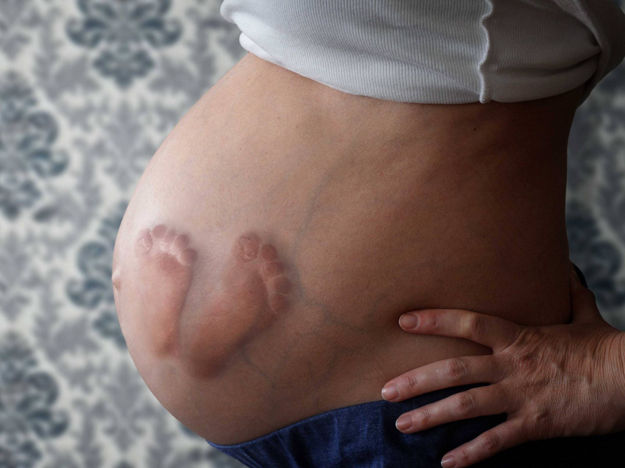 при беременности может увеличиться только одна грудь фото 46