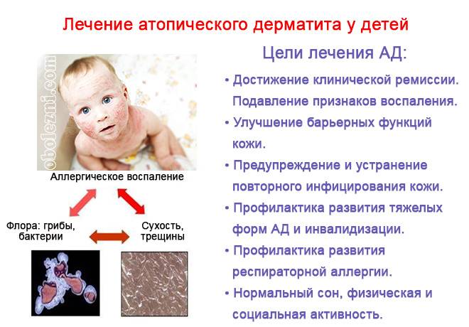 Фарматека » атопический хейлит при атопическом дерматите у детей