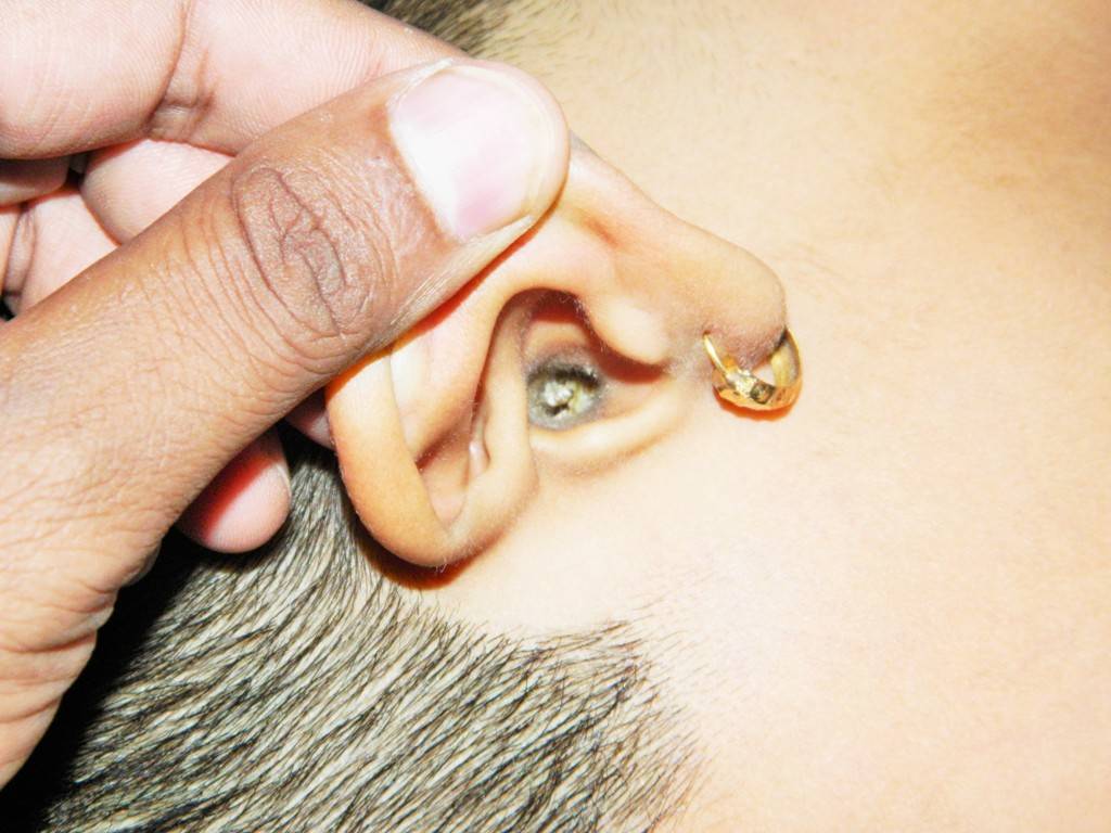 Как почистить ребенку уши от серной пробки