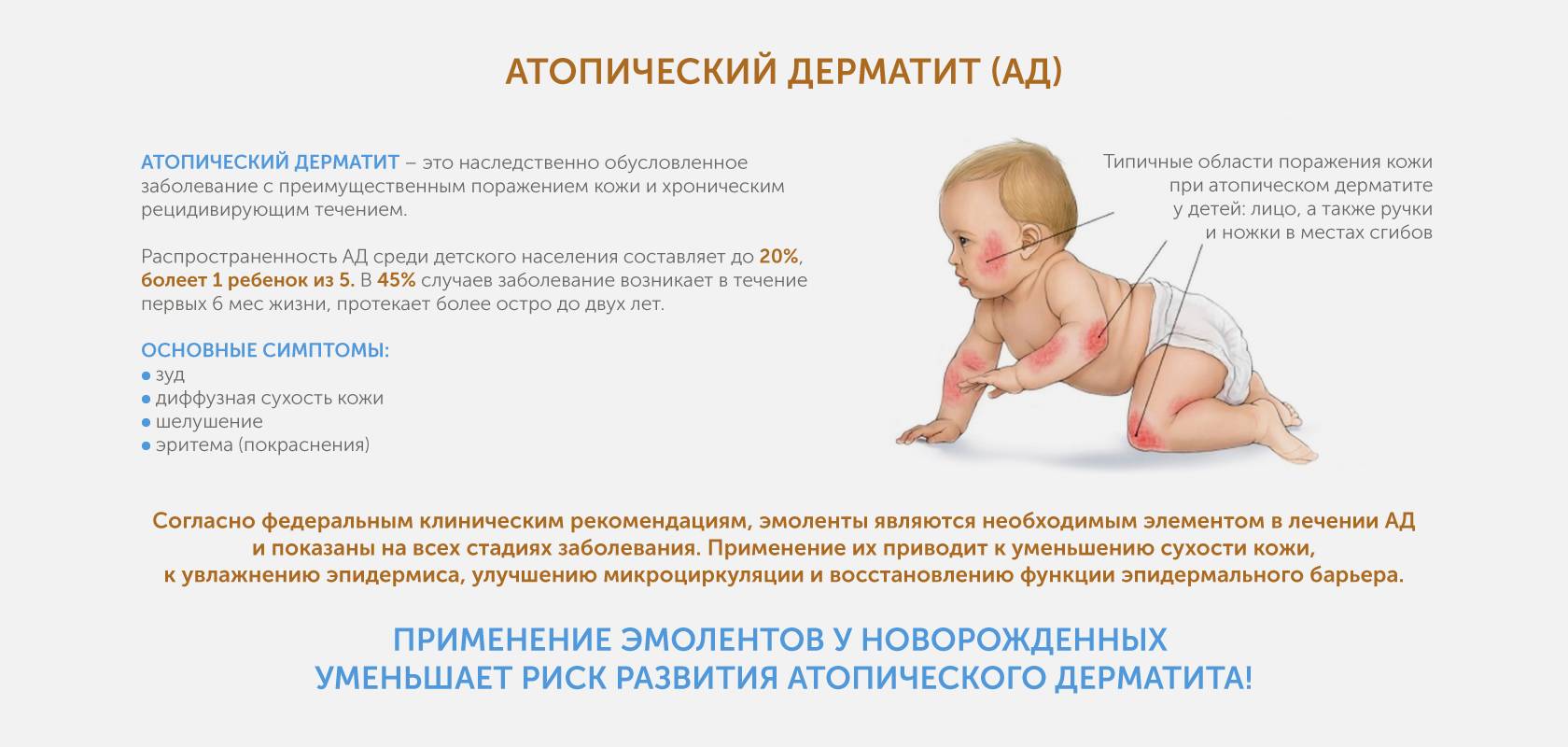 Использовать в течение 6 месяцев. Атопический дерматит клинические рекомендации 2020. Атопический дерматит причины у детей 4 месяца. Симптомы атопический дерматит у ребёнка 6 месяцев. Дерматит у 4 месячного ребенка.