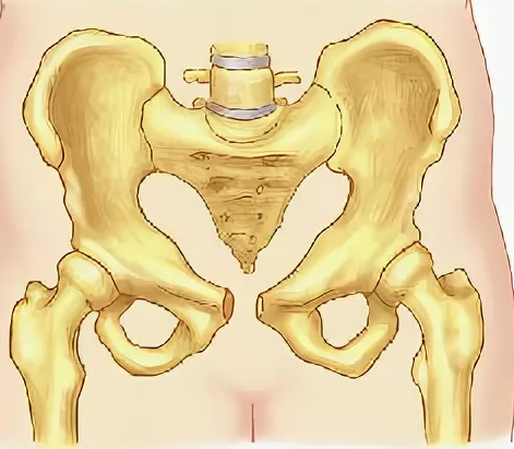 Расхождение костей таза при беременности: симптомы и когда начинается, что делать
