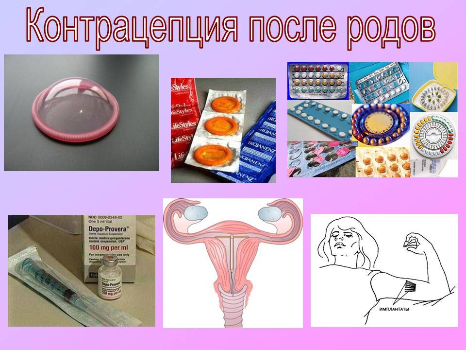 Контрацепция при грудном вскармливании: топ-7 методов | nestle baby
