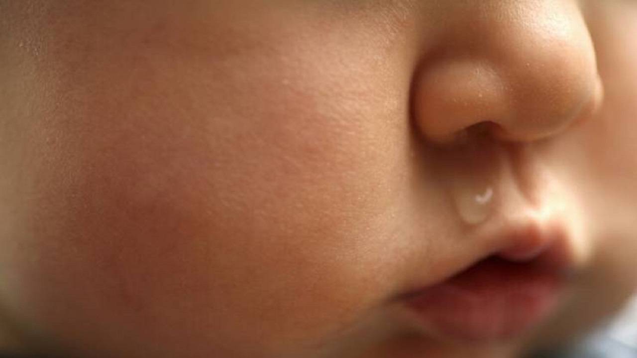 Потница у новорожденного ребенка: как выглядит (фото) – эл клиника